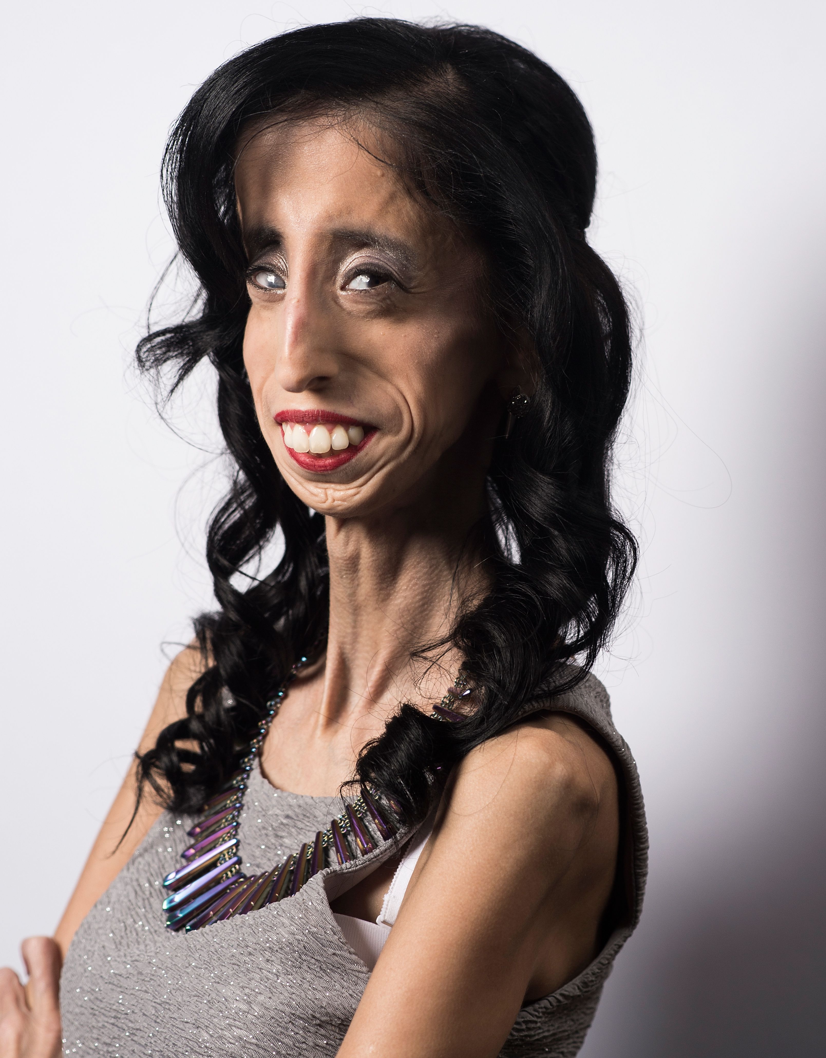 The the world ugliest and man in woman 15 Countries