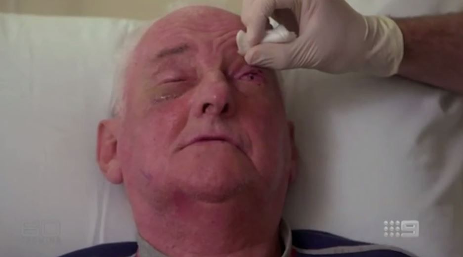 Technology Saves the Day in a Weird Way: Man Loses Eyesight, Doctors  Restore It by Implanting His Tooth in His Right Eye